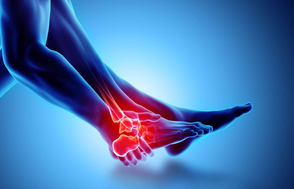 ankle sprain or ligament injury